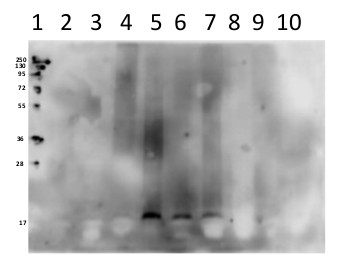 western blot using anti-V ATPase subunit c antibodies